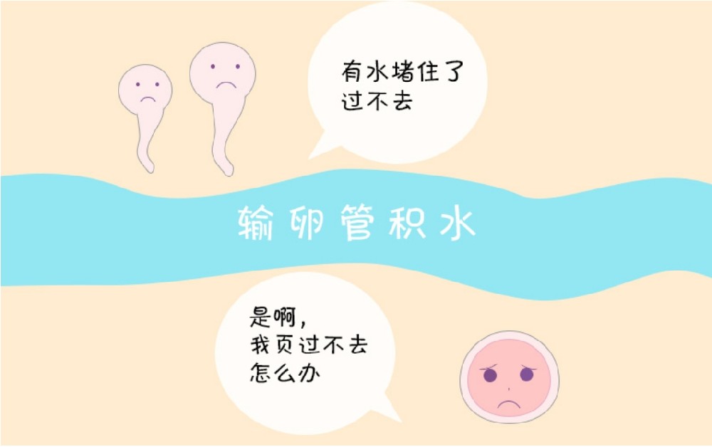 输卵管积水.png