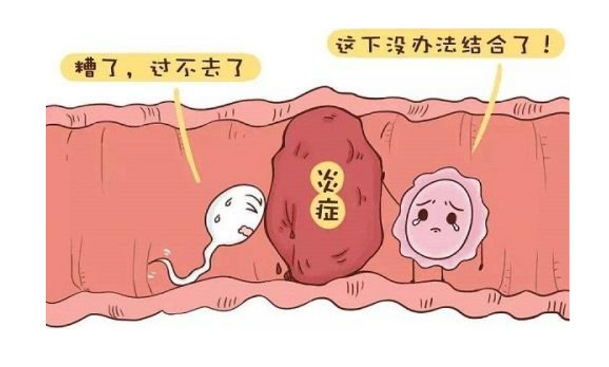 输卵管炎还会导致女性不孕？是什么原因造成的？