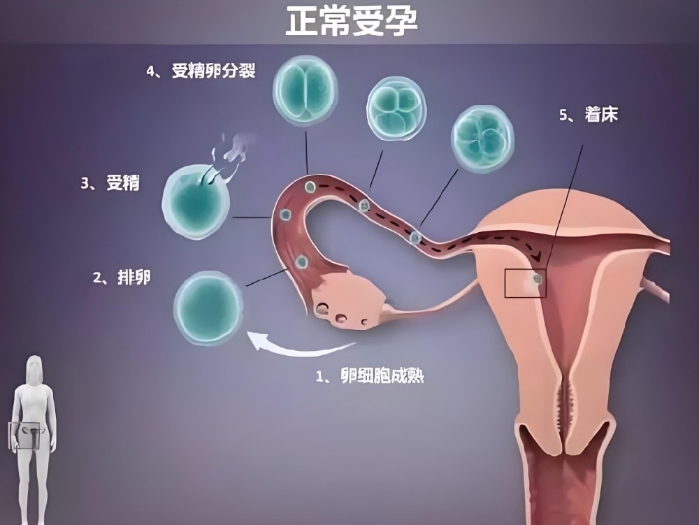 宫腔形态不好对试管的影响?