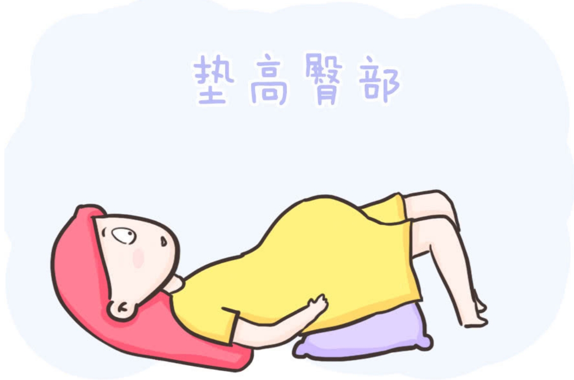 盆底肌训练.png