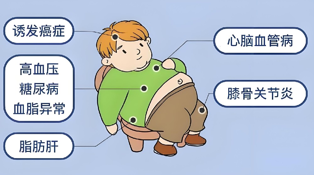 男性肥胖.png