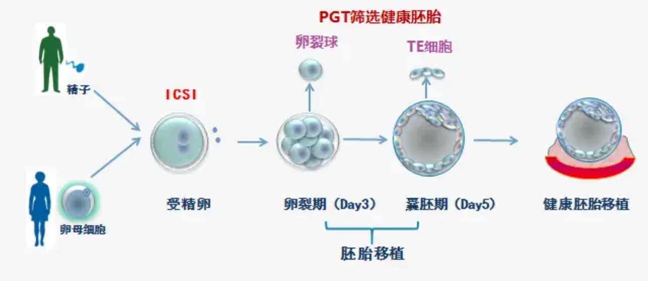 PGT-A植入前基因筛查.png