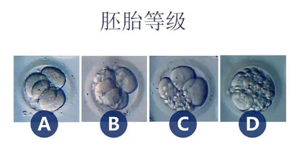 试管婴儿胚胎的一级二级三级等级划分情况