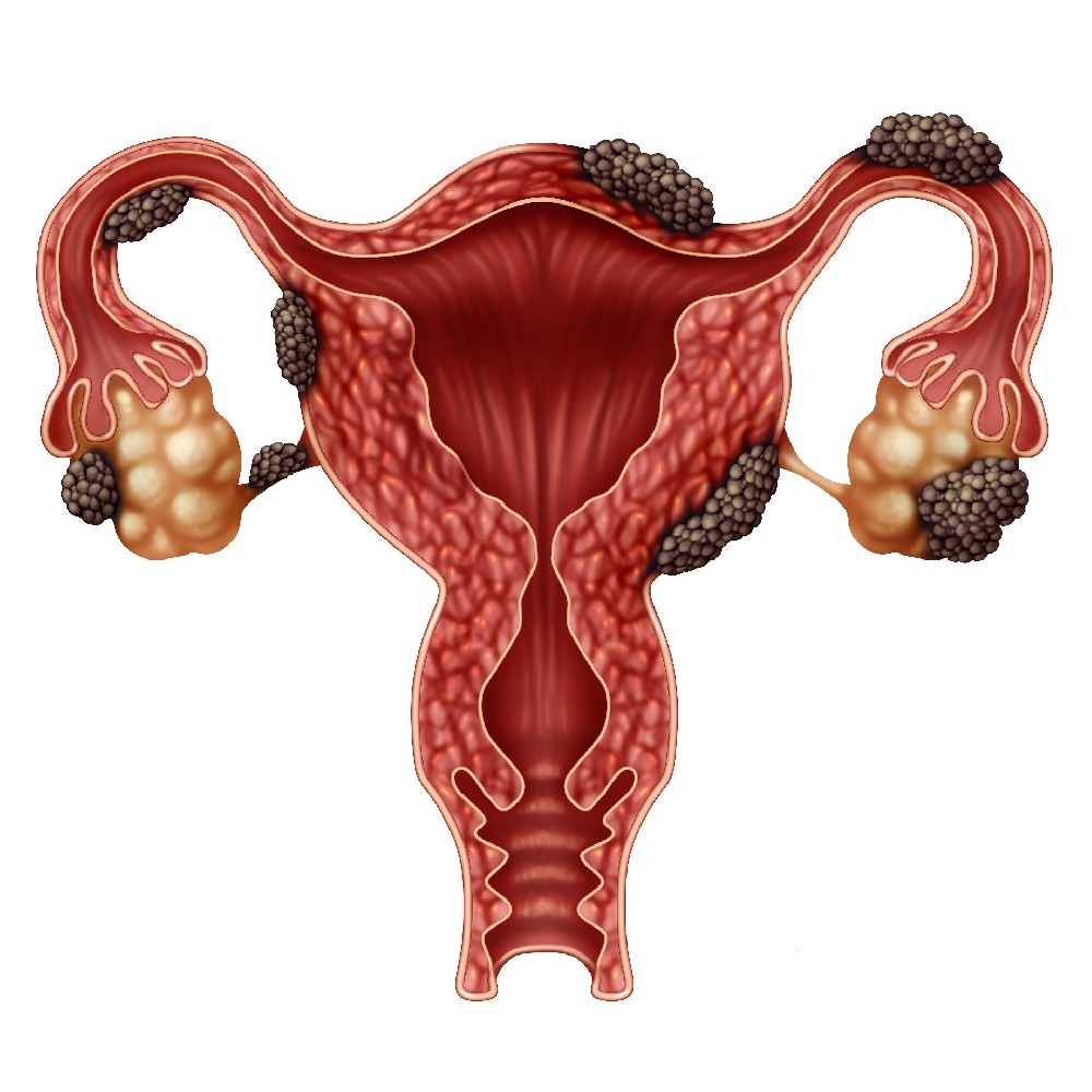 子宫内膜形态与试管移植着床几率的相关性